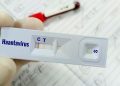 Warga Kulon Progo Suspek Virus Hanta Terbukti Negatif