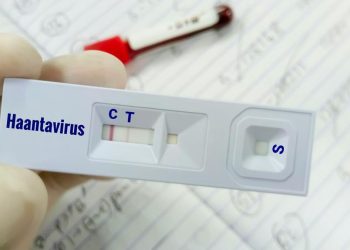 Warga Kulon Progo Suspek Virus Hanta Terbukti Negatif