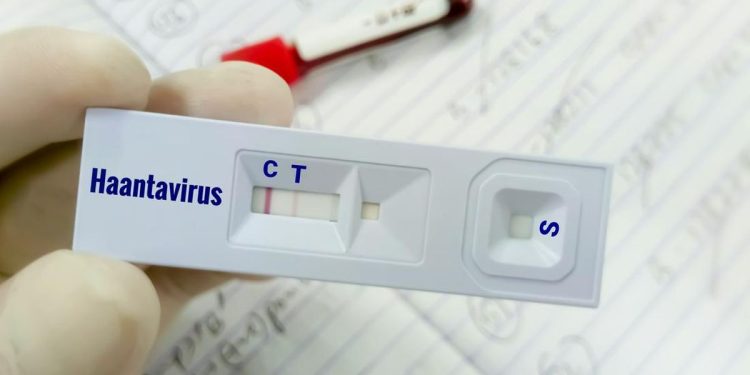 Warga Kulon Progo Suspek Virus Hanta Terbukti Negatif