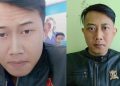Kepala YTR Korban Infeksi Serius, Terdapat Belatung di Tubuhnya