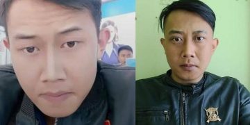 Kepala YTR Korban Infeksi Serius, Terdapat Belatung di Tubuhnya